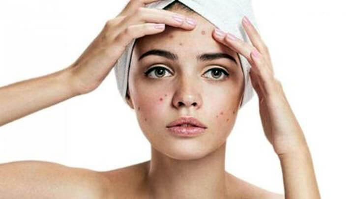 100% Natural Powder Purity Papaya Extract Powder Anti Acne Skin Smooth Reducing Hyperpigmentation Free Shipping